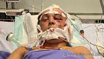 Uninsured Brit is in a coma with severe brain injuries after accident on first holiday without family in Zante: Distraught mother pleads for help to raise funds