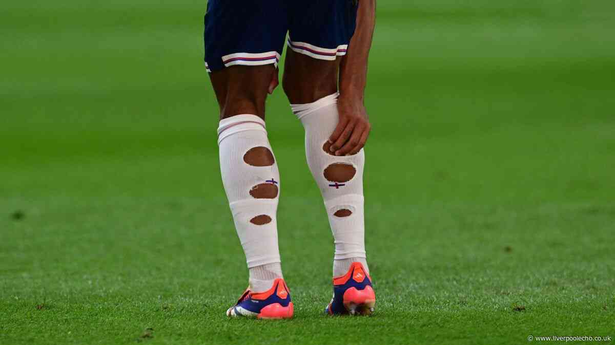England fans baffled over holes in players' socks - but there's good reason