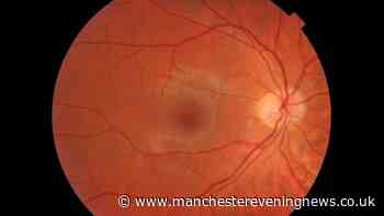 A simple eye test, with a little help from AI, could detect diseases long before symptoms appear
