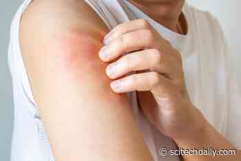 This Surprising Hair Type Could Hold the Key to Chronic Itch Relief