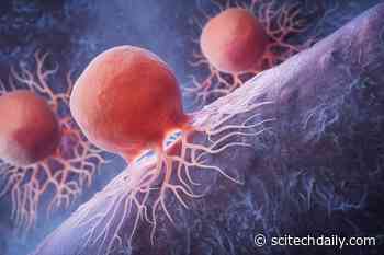 New Study Reveals Unexpected Way To Destroy Pancreatic Cancer Cells