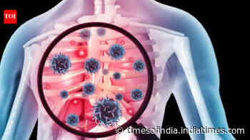 One in three TB cases found in Northeast screening had no symptoms
