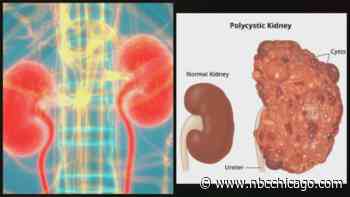 New bill in Congress would aim for cure to common kidney disease