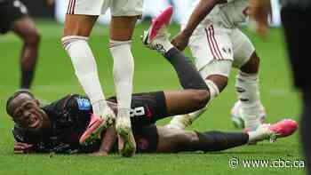 Canada midfielder Ismaël Koné undergoes surgery to repair broken leg