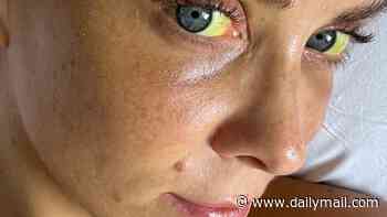 Urgent health warning after six cases of liver damage linked to an unapproved weight loss drug