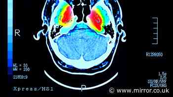 Daily 'fountain of youth' drink could lower dementia and diabetes risk