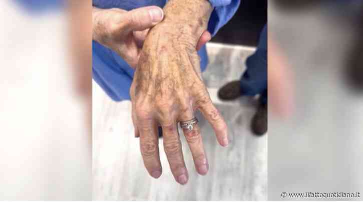 “Lo abbiamo raccolto, ci siamo guardati e ci siamo detti: ‘Cosa ne facciamo?'”: ritrova nel water l’anello di fidanzamento perso 10 anni prima, l’incredibile scoperta degli idraulici