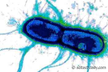 Scientists Discover the “Achilles’ Heel” of Two of the World’s Deadliest Diarrhea Bacteria