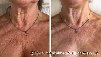 Sagging neck cream reduced from £86 to £32 said to be 'so effective' women in their 70s love it