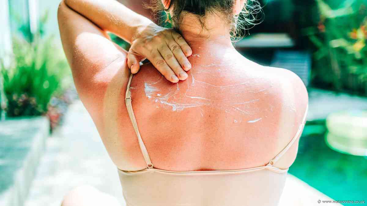 One in five adults believe sunburn is necessary for a good tan