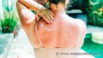 One in five adults believe sunburn is necessary for a good tan