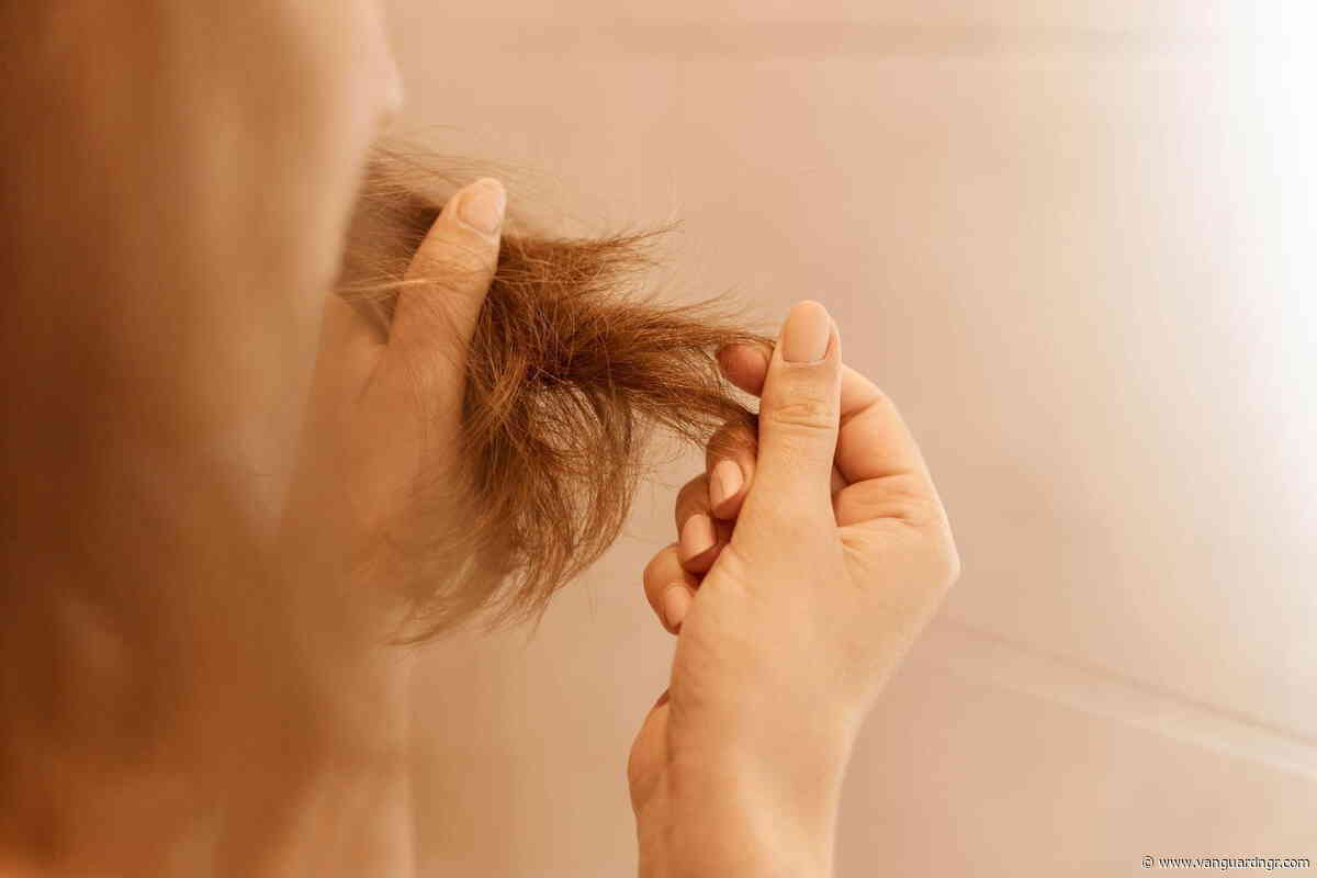 The Hidden Connection Between Persistent Flakes and Long-Term Balding
