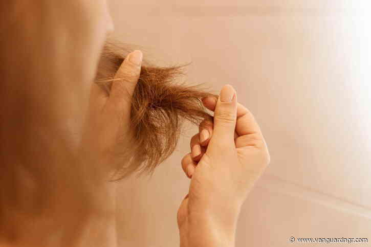 The Hidden Connection Between Persistent Flakes and Long-Term Balding