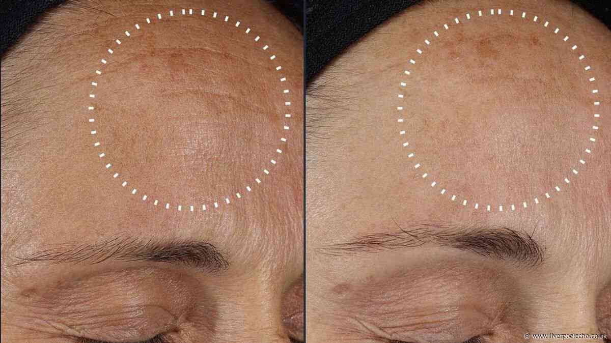Medik8's 'Botox in a bottle serum' cut to lowest price in Amazon Prime Day deal