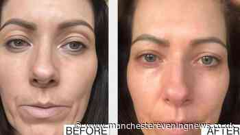 Award-winning anti-ageing serum from doctor hailed 'King of Botox' gets rare discount