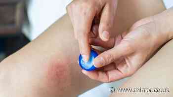 Doctor's solution stops chafing and heat rash as he says 'use this cream'