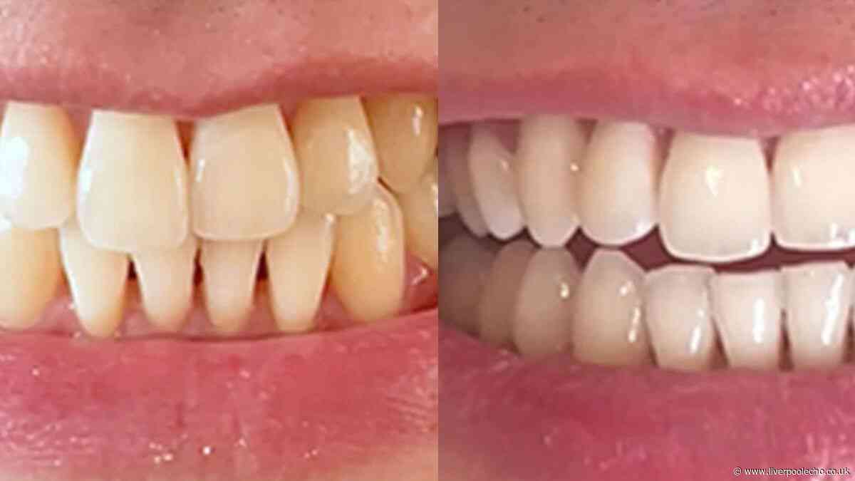 Over 60s with 'yellow teeth' are buying £10 whitener 'for myself and my friend'