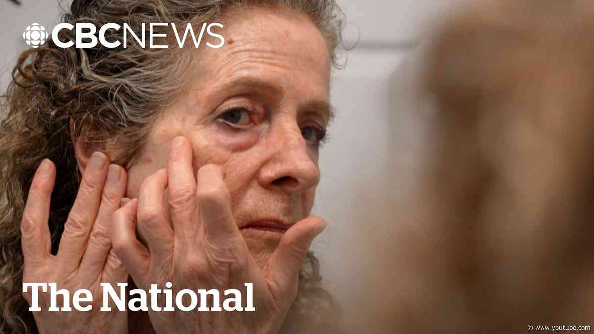 Dermatology wait times skyrocket in Canada — unless you want Botox