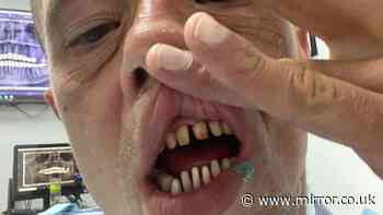 Man facing £40,000 bill as Turkey teeth start to fall out