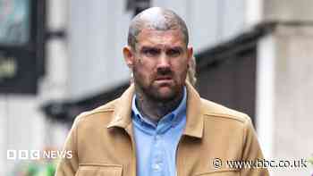 Baby injured 'like a car crash victim', trial told