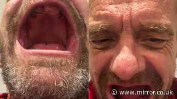 Dad can finally smile again after years of pain and embarrassment