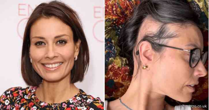 Melanie Sykes reveals photo of extreme alopecia after going ‘two-thirds bald’