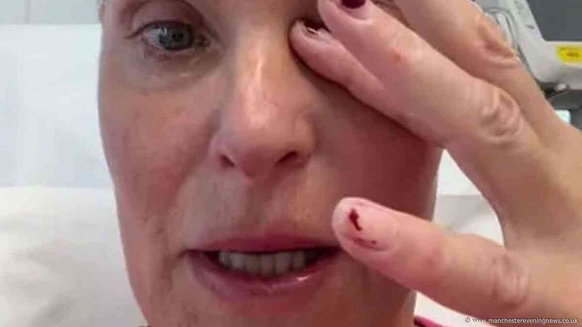 Coronation Street's Tracy Shaw breaks down in tears in emotional health update
