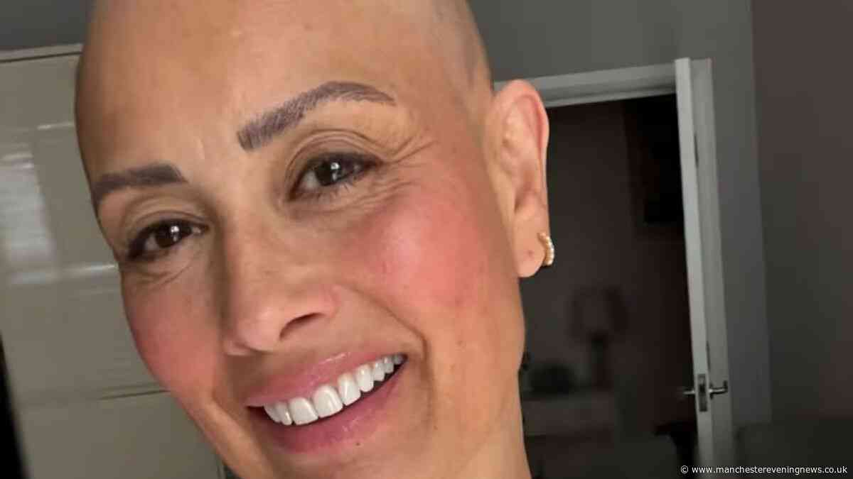 Melanie Sykes reveals entirely bald head in brave alopecia update