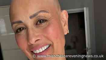 Melanie Sykes reveals entirely bald head in brave alopecia update