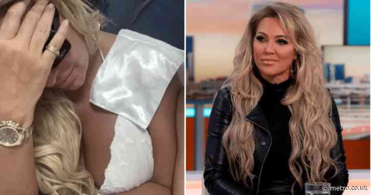 Reality star ‘scarred for life’ after being mauled by XL Bully