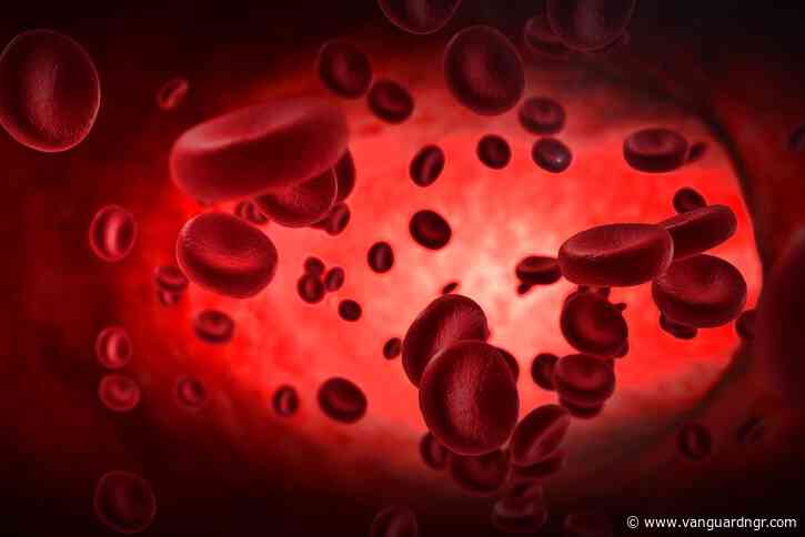 Sickle Cell Disease: 736 children get free treatment in Kano