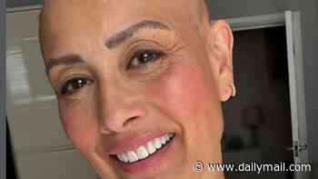 From TikTok hair styles to not eating enough meat, experts reveal what can trigger alopecia, as Melanie Sykes reveals she's now 'two-thirds' bald