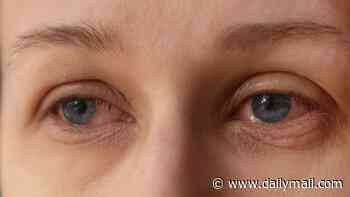DR SCURR shares the unexpected reason why your eyes are constantly watering - even in warm weather - and the FREE solution that takes just seconds