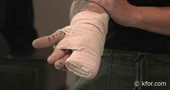 Oklahoma woman loses two fingers in firework explosion