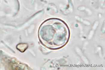 Parasite that causes ‘explosive diarrhea’ is spreading across the US
