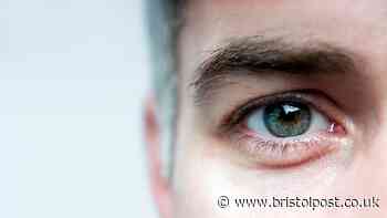 Optometrist says kitchen cupboard item can ease common eye problem