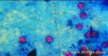 What Is Cyclosporiasis? 145 Sick in 17 States as Outbreak Tests US Food Safety