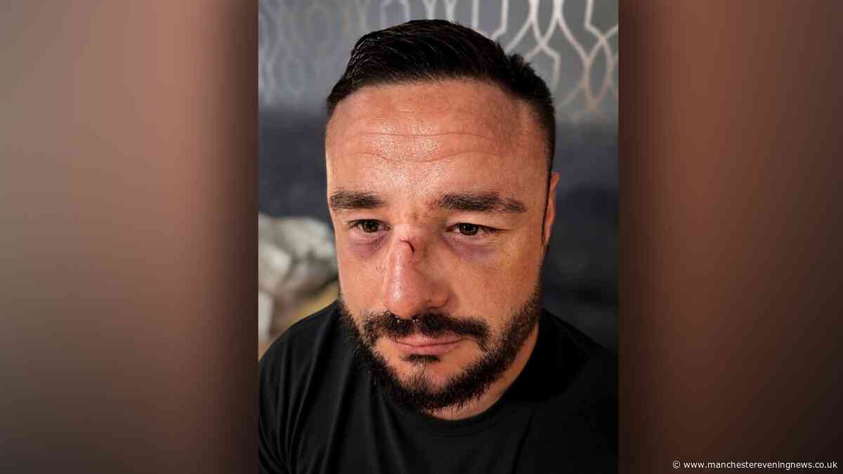 Man set upon in brutal attack caught on CCTV told by police 'case is closed'