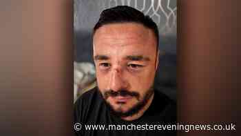 Man set upon in brutal attack caught on CCTV told by police 'case is closed'