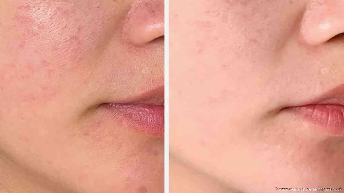 ‘I've used a Doctor's moisturiser for 5 years and love it, but love new alternative more’