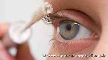 Augenringe durch Wimpernserum? Arzt warnt vor Nebenwirkungen
