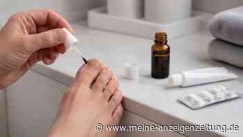 Nagelpilzmittel im Test: Stiftung Warentest warnt vor vielen beliebten Produkten