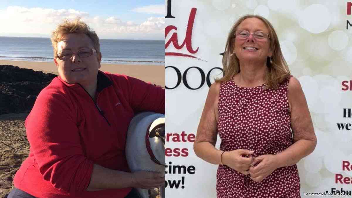 I lost 10 stone after doctors told me I was too big to have an operation