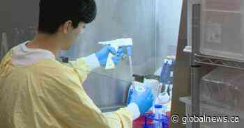 University of Calgary developing new immunotherapy cancer treatment