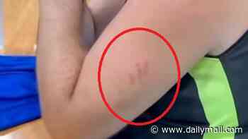 The disturbing scratch marks on accused Thai teen killer's arm and neck appear damning - but the Aussie gave cops a wild excuse