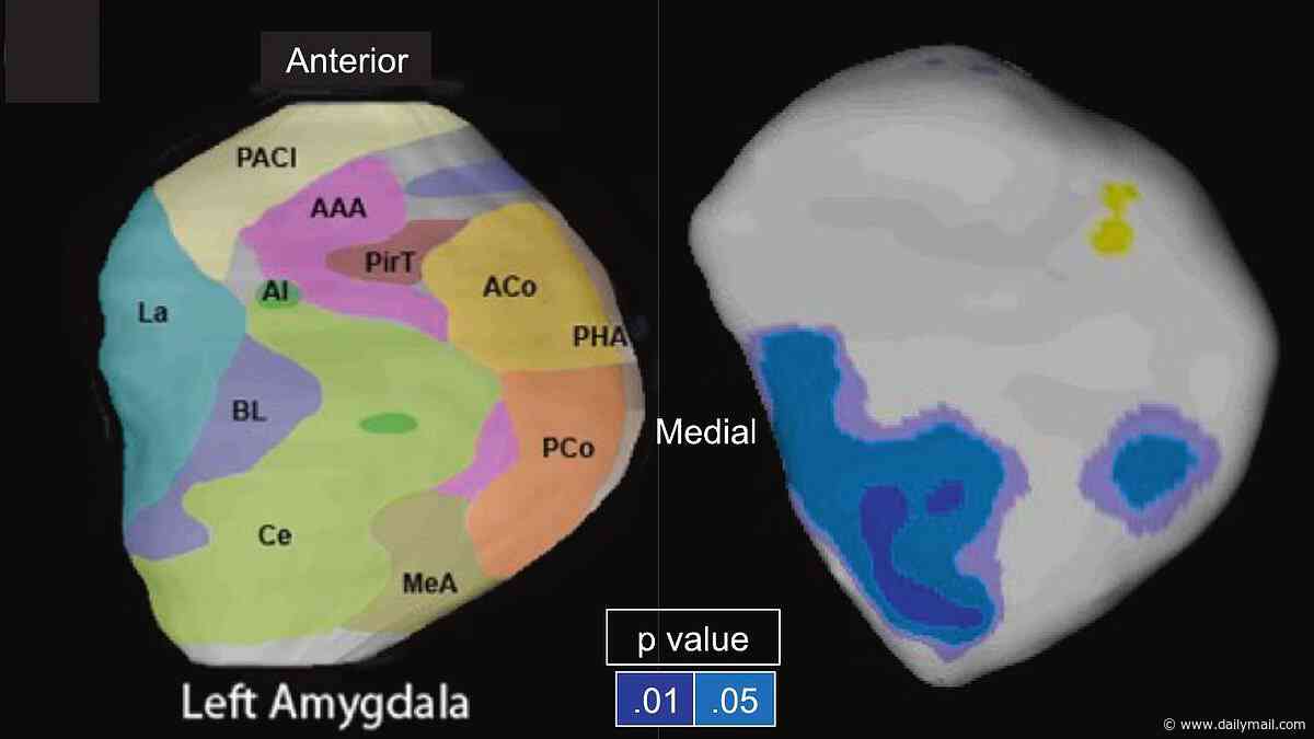 The brain scan that could reveal a cold-blooded killer: Scientists discover key difference in people who commit premeditated murder