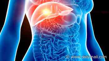 Takeaways and beers: Experts discover the lifestyle choices that trigger most dangerous form of bowel cancer