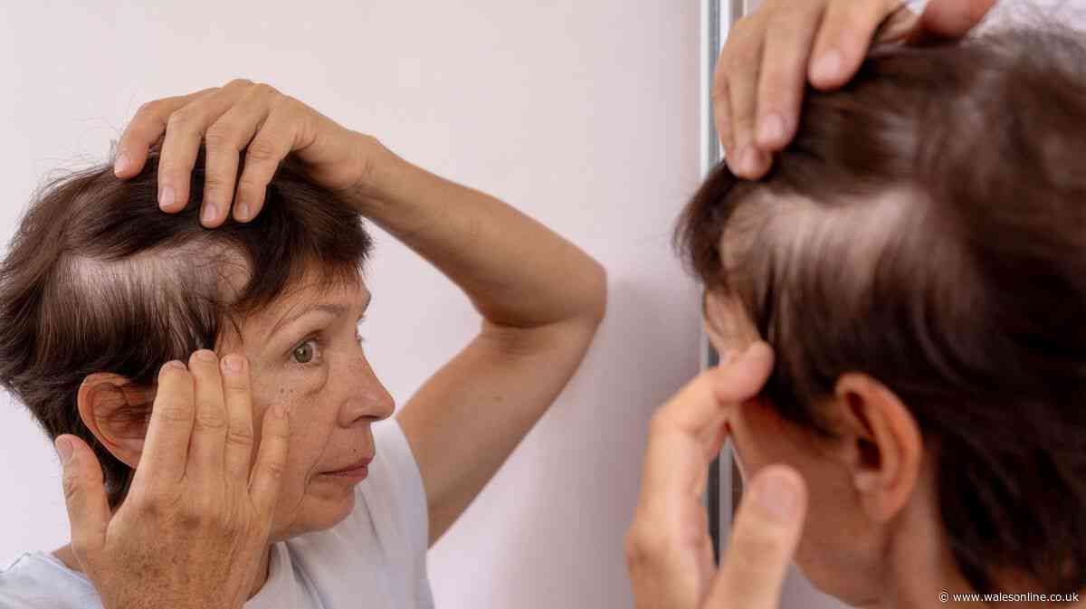 Dr Amir Khan says your hair loss could be linked to this number
