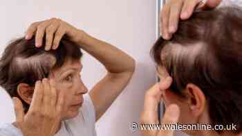 Dr Amir Khan says your hair loss could be linked to this number