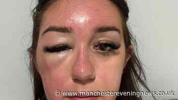 Brit holidaymaker's 'eye bags' lead to mystery illness trapping her in Greek hospital